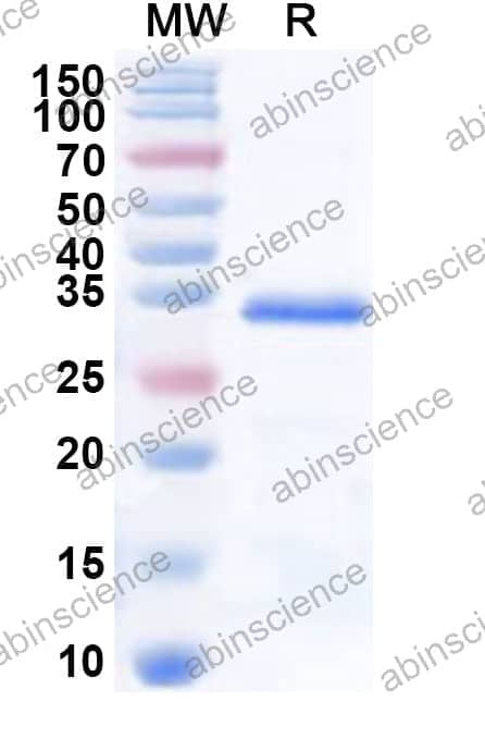 Human SNAPC1 Recombinant Protein (N-His)