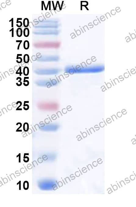 Human MAN2A1 Recombinant Protein (N-His)