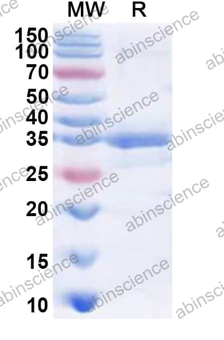 Human PHKG1 Recombinant Protein (N-His)