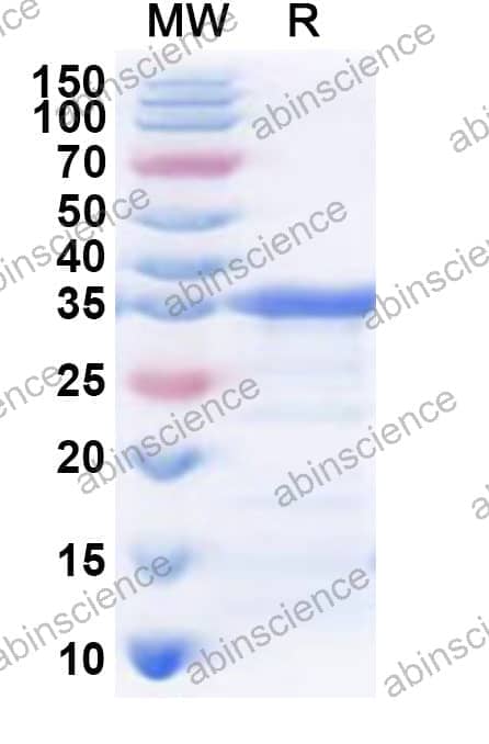 Human TKFC Recombinant Protein (N-His)