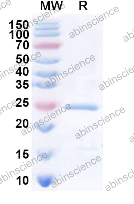 Human SLC5A3 Recombinant Protein (N-His-KSI)