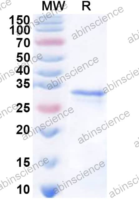 Human DNASE1L3 Recombinant Protein (N-His)
