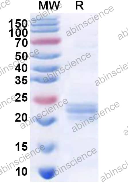 Human RAB38 Recombinant Protein (N-His)