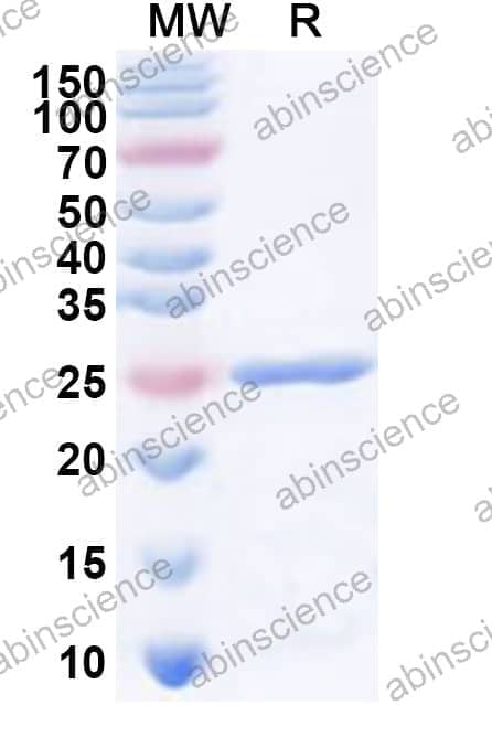 Human ART4 Recombinant Protein (N-His)