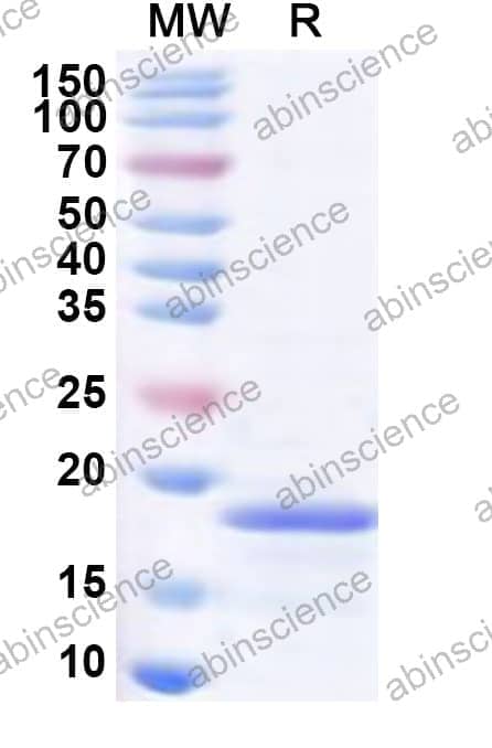 Human PLEKHS1 Recombinant Protein (N-His)