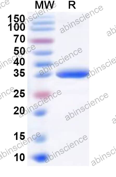 Human RBM33 Recombinant Protein (N-GST & C-His)