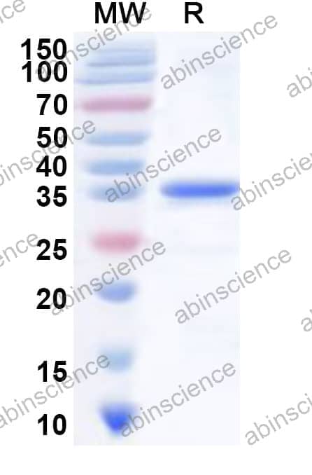 Human IER3 Recombinant Protein (N-GST & C-His)