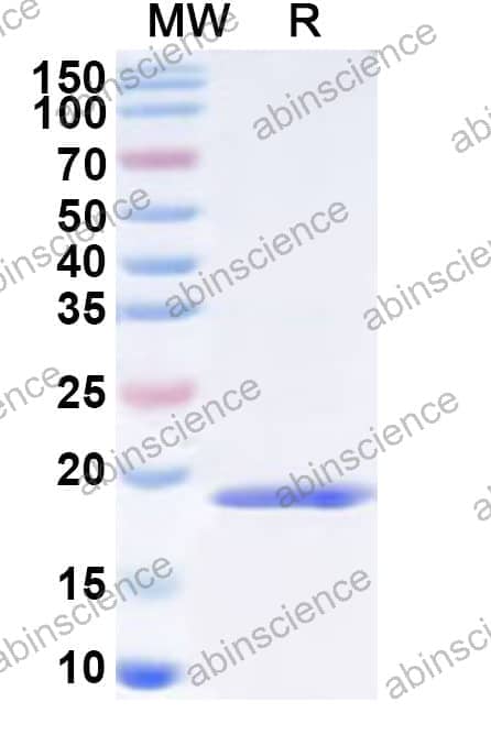 Human POLR2H Recombinant Protein (N-His)