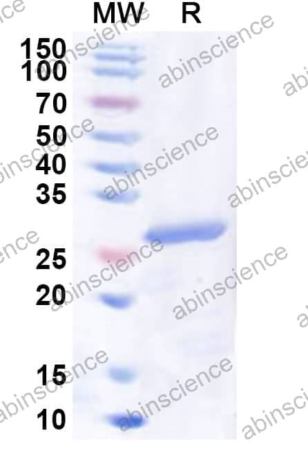 Human NR2F6 Recombinant Protein (N-His)