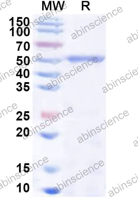 Human CYP2C9 Recombinant Protein (N-His)
