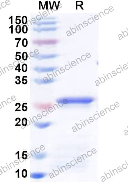 Human SMARCA4 Recombinant Protein (N-His)