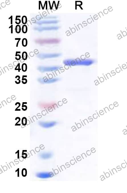 Human PHF2 Recombinant Protein (N-His)