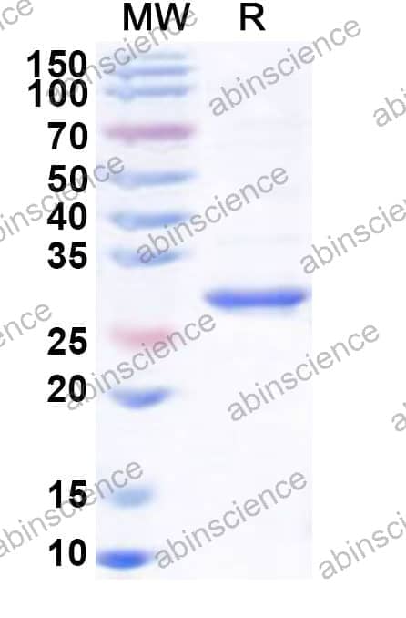 Human PNMT Recombinant Protein (N-His)