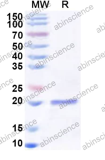 Human RPS17 Recombinant Protein (N-His)
