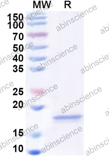 Human LY86 Recombinant Protein (N-His)