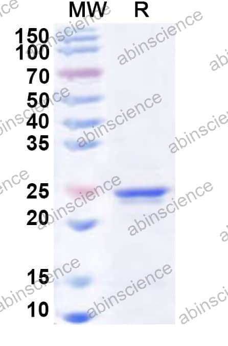 Human SIX6 Recombinant Protein (N-His)