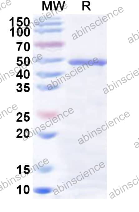 Human GCAT Recombinant Protein (N-His)