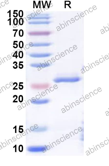 Human NR2F1 Recombinant Protein (N-His)