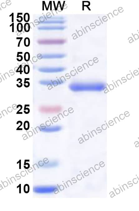 Human LDHC Recombinant Protein (N-His)