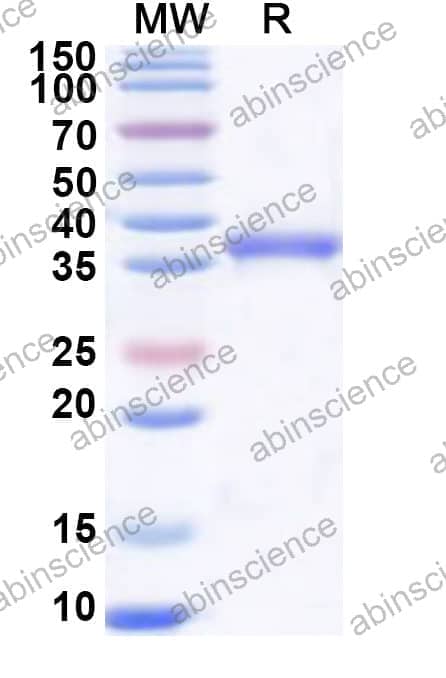 Human USP48 Recombinant Protein (N-His)