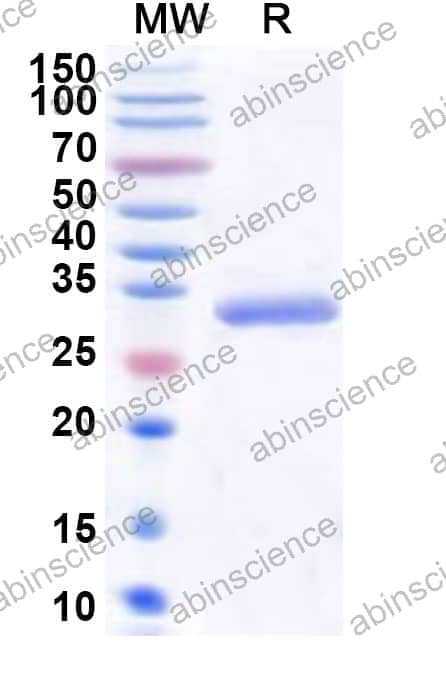 Human PRKACG Recombinant Protein (N-His)