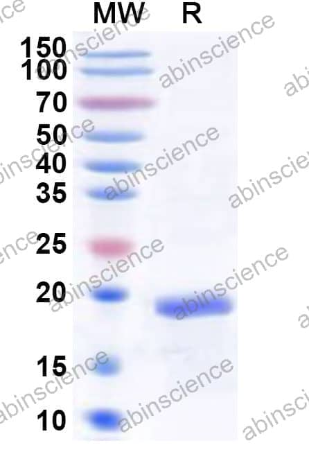 Human LMO1 Recombinant Protein (N-His)