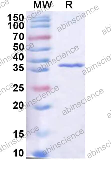 Human RASSF2 Recombinant Protein (N-His)