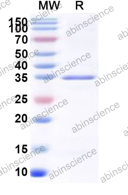 Human RBMY1B Recombinant Protein (N-GST & C-His)