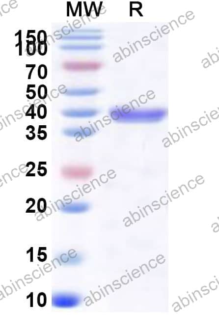 Human CHMP4B Recombinant Protein (N-His-SUMO&C-Strep)