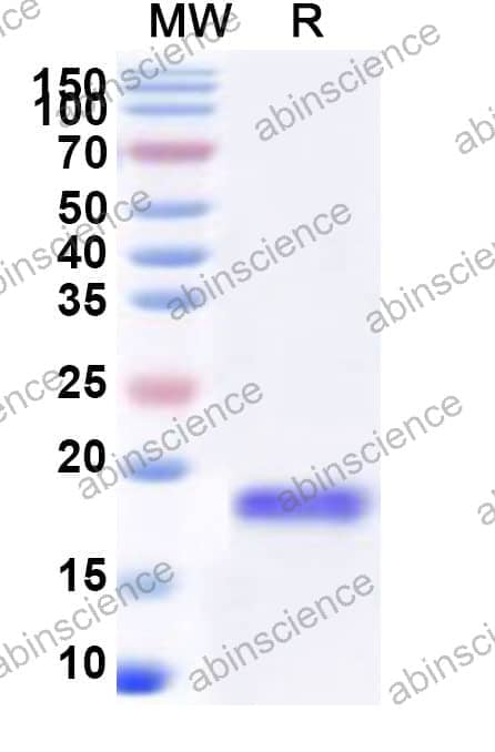 Human EIF1AX Recombinant Protein (N-His)