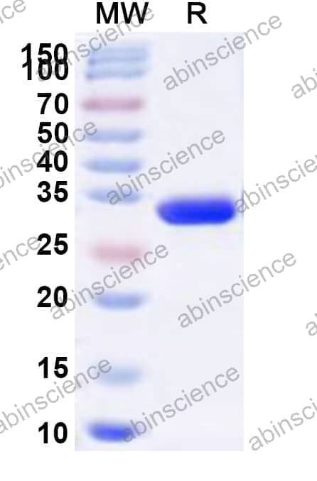 Human RPS4X Recombinant Protein (N-His)