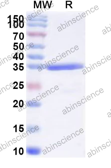 Human TOX3 Recombinant Protein (N-GST & C-His)