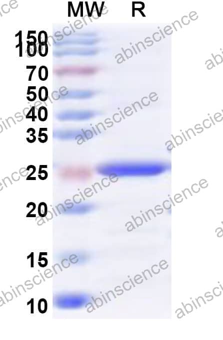 Human CSTF2 Recombinant Protein (N-His)