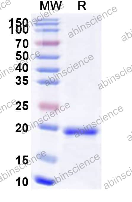 Human RNF113A Recombinant Protein (N-His)