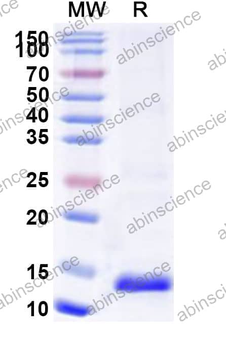 Human ARPC5 Recombinant Protein (N-His)