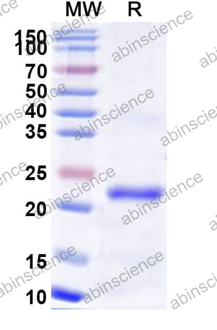 Human MEFV Recombinant Protein (N-His)