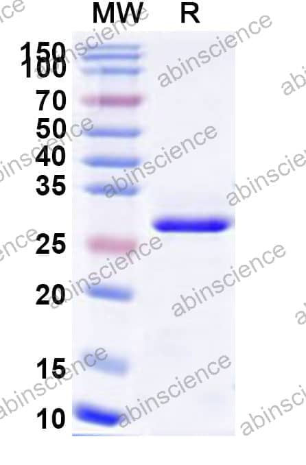 Human MRAS Recombinant Protein (N-His)