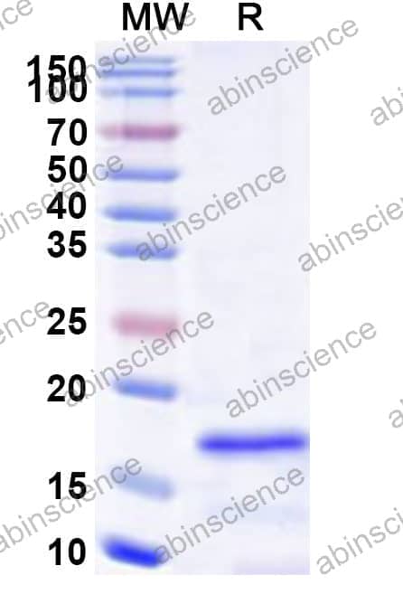 Human SAP18 Recombinant Protein (N-His)
