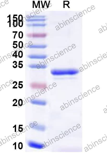Human SEC16A Recombinant Protein (N-His)