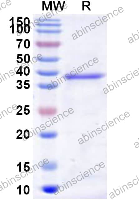 Human RNMT Recombinant Protein (N-His)