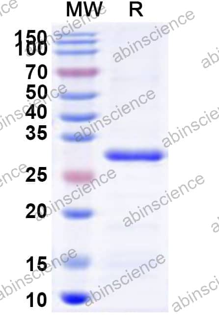 Human HR Recombinant Protein (N-His)