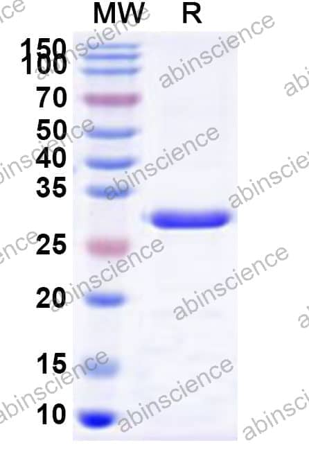 Human SLC26A4 Recombinant Protein (N-His)