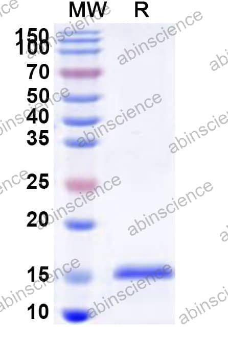 Human FRS3 Recombinant Protein (N-His)