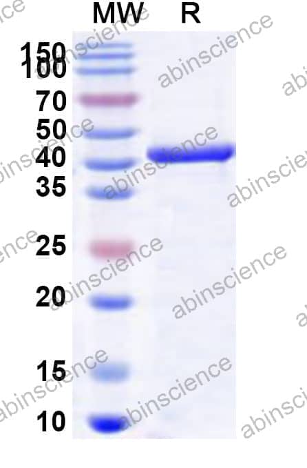 Human ORC4 Recombinant Protein (N-His)