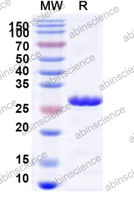 Human TBC1D4 Recombinant Protein (N-His)