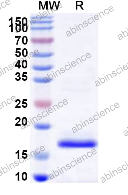 Human CYTIP Recombinant Protein (N-His)