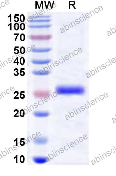 Human LDB3 Recombinant Protein (N-His)