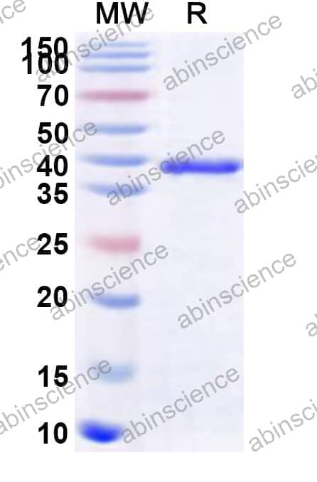 Human USP12 Recombinant Protein (N-His)
