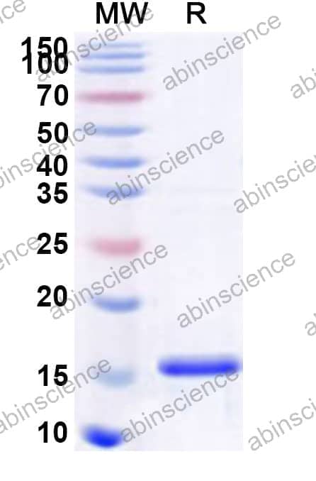 Human ARHGEF15 Recombinant Protein (N-His)