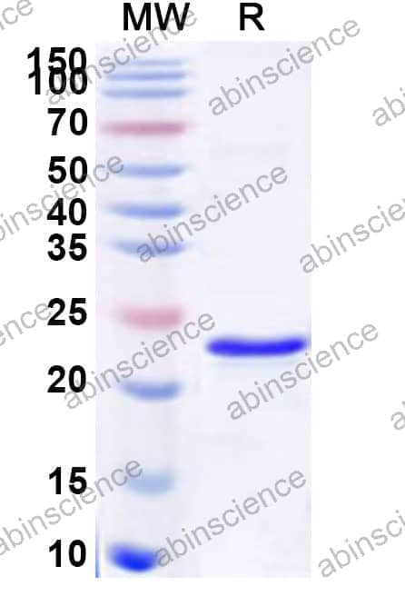 Human SAP30 Recombinant Protein (N-His)